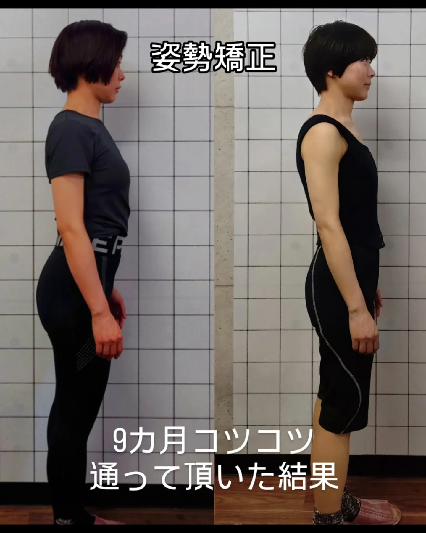 【📸姿勢矯正ビフォーアフター公開!】